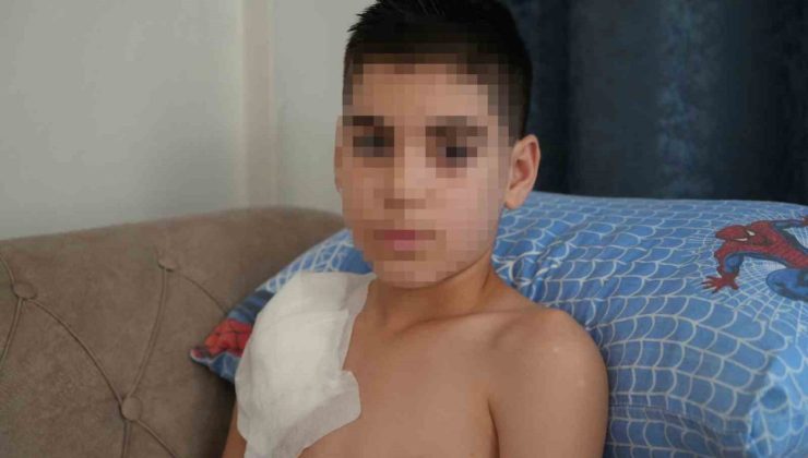 Vücudu köpek tarafından parçalanan Yunus’un kolu kullanılamaz hale geldi, aile adalet arıyor