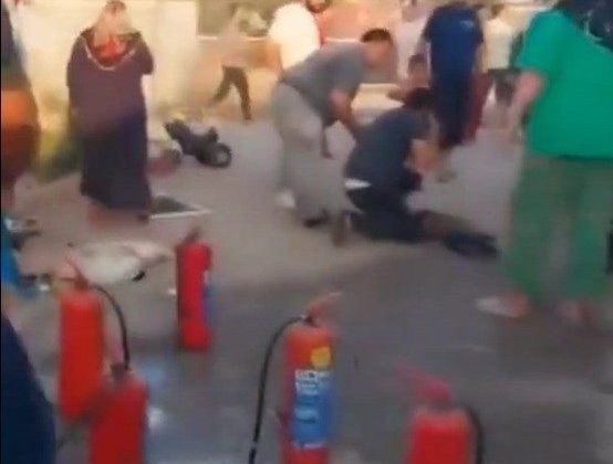 Yangında ağır yaralanan çocuk hayatını kaybetti